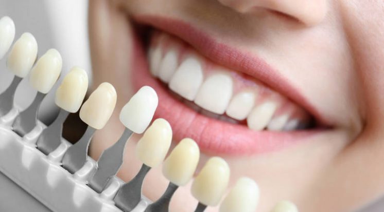AC Paiva Odontologia Implantes Dentários Blog
