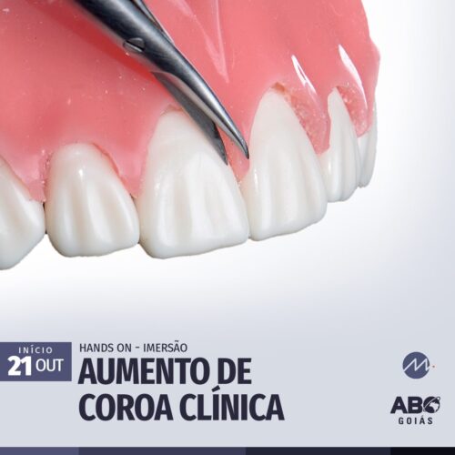 AC Paiva Odontologia Curso-Aumento-de-Coroa