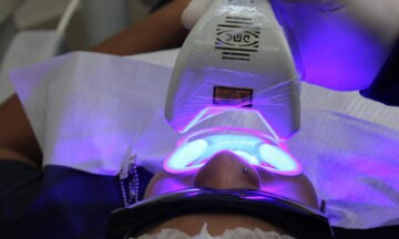 AC Paiva Odontologia Clareamento Dental